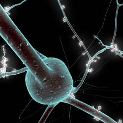 synapses of a mammalian brain