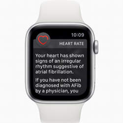 The latest Apple Watch incorporates a heart rate sensor that can provide early warning of atrial fibrilliation.