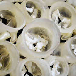 Multi-material physical models of patients’ aortic heart valves, each with its own unique size, shape, and amount of calcification.