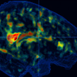 brain scan-like image