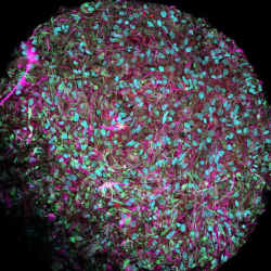 Brain organoid seen through the microscope with neurons stained magenta.